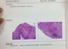 ʪಡ鱨